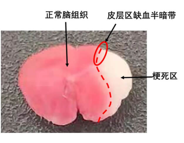 4-TCC染色法.jpg 4-TCC染色法.jpg